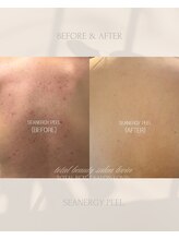 ラヴィン なんばスカイオ店(Lovin)/シーナジーピーリング