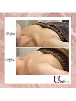 ウルエッテ(UluEtte)/福岡バストアップサロンならここ