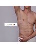 残り1名★【全身メンズ脱毛（顔/VIO含まない）】最短で脱毛完了★¥19800