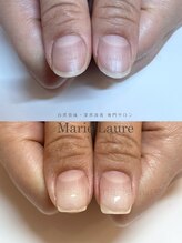 マリーロール 梅田店(Marie Laure)/深爪矯正/自爪育成/自爪風