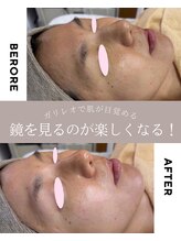 ルームエイトエイティスリー 新宿(R883)/ ガリレオピーリング