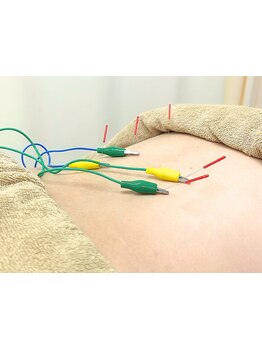 鍼灸施術を受けたい