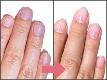 アモ 坂戸(’Amo)/深爪矯正・自爪育成 坂戸/北坂戸