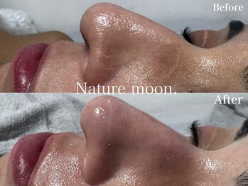 ナチュールムーン(Nature moon.)/毛穴洗浄