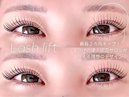 アフェット(affetto)の写真