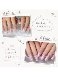 before→after