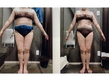 パーフェクトボディプレミアム 名古屋駅前店(PERFECT BODY PREMIUM)/お客様　ビフォーアフター（13）