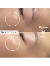 ホワイトワックス 浜松店(WHITE WAX)/お肌のトーンアップ効果も★