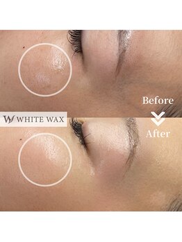 ホワイトワックス 浜松(WHITE WAX)/お肌のトーンアップ効果も★