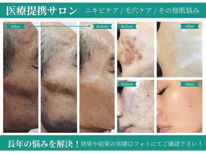 ベルスタイル(Bell style)の写真