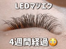 ハジナ(HAZINA)の雰囲気（LED施術4週間経過★個人差はありますが、モチの良くなる方多数♪）