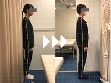 ミライズ整体院 三宮本院/事例【20代女性・肩こり】