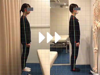 ミライズ整体院 三宮本院/事例【20代女性・肩こり】