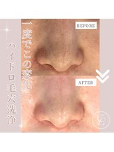 エンルーチェ プラスエイト(en;Luce+8)/