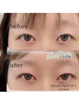 ダイヤモンドアイズ 調布店(DIAMOND EYES)/くらげロッド 立ち上げ+丸み