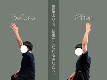 巡 金山店(MEGURI)/肩の痛み改善