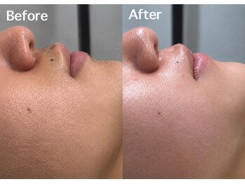 ザ スタイル サロン トーキョー 渋谷(The Style Salon TOKYO)の写真/【人気フェイスワックス】つるんとなめらかな垢抜け肌へ