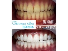 ホワイトニングサロン ビアンカ 浜松若林店(BIANCA)