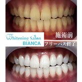 ホワイトニングサロン ビアンカ 浜松若林店(BIANCA)