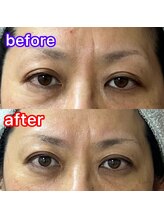 シュシュ(chouchou)/フェイシャル/ビフォーアフター