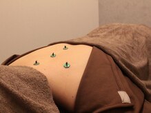 ラクセイ(RAKUSEI)/【灸（きゅう）施術】