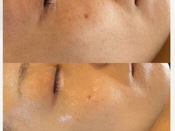 リノアンド(Lino&)/毛穴ケア、トーンup、水分爆発