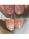 爪の形の悩み解消ロングネイル