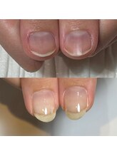 キュア(Cure.)/爪の形の悩み解消ロングネイル