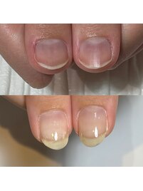爪の形の悩み解消ロングネイル