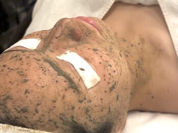 エルベ(ellbe)の写真/本気の美肌革命でエイジング対策を◎最高金賞受賞の幹細胞ハーブピーリングで自分史上最高のうるツヤ肌へ★
