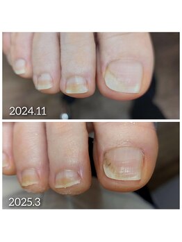 爪切り屋 足楽/