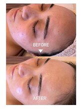 エイティ(Atey)/ハイドロ