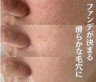 プラセル(Placer)