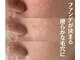 プラセル(Placer)の写真