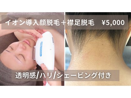 ウィローの写真