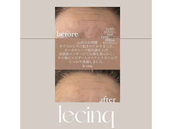 ルサンク(le cinq)