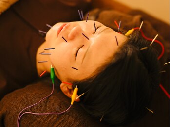 十三/美容鍼 頭皮鍼 マッサージ