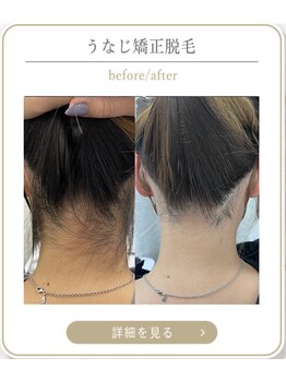 ミース 上野店/スッキリうなじに感動