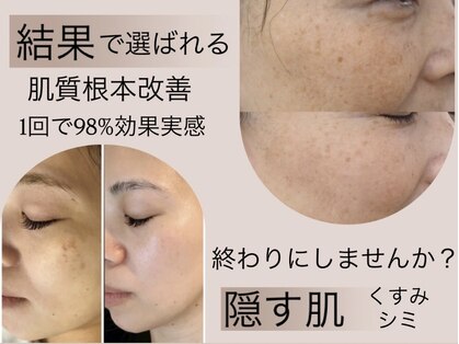 リアプア(Li'a)の写真