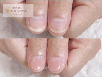 グラシナ 名古屋金山店/(深爪／長さだし/フィルイン)
