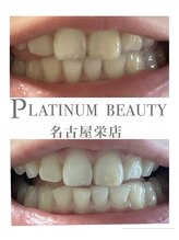 プラチナムビューティー 名古屋栄本店(PLATINUM BEAUTY)/お客様Before After