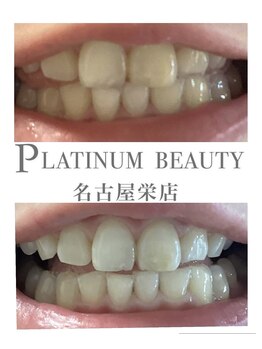 プラチナムビューティー 名古屋栄本店(PLATINUM BEAUTY)/お客様Before After