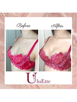 ウルエッテ(UluEtte)/お椀型のバスト/博多バスト/福岡