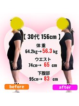 さらさ整骨院/ダイエット整体ビフォーアフター