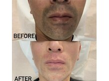 グランツ(GLANZ)/