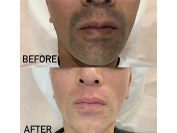 グランツ(GLANZ)/