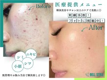 ベルスタイル(Bell style)の雰囲気（長年のお肌悩みご相談下さい！当店で自信の持てる美肌に改善♪）