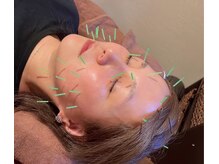 彩(イロドリ)の雰囲気（肌の内側から輝く！肌質改善）