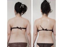 コリオ(KoRiO)/痩身3回目のお客様［狭山ヶ丘］