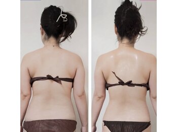 コリオ(KoRiO)/痩身3回目のお客様［狭山ヶ丘］